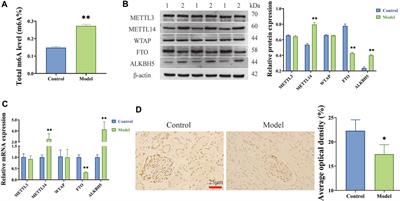 Overexpression of FTO inhibits excessive proliferation and promotes the apoptosis of human glomerular mesangial cells by alleviating FOXO6 m6A modification via YTHDF3-dependent mechanisms